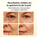 Bálsamo de Colágeno ANTIARRUGAS (1+1 GRATIS)